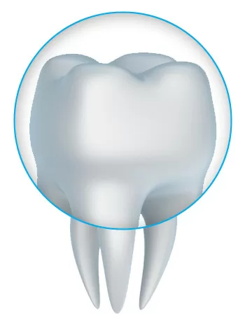 Dental crowns for dental emergencies in Clovis and Fresno, CA